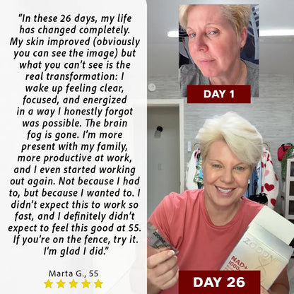 ZOOONE Liquid NAD+ 1000 mg – Berry Flavor, 30 Packets