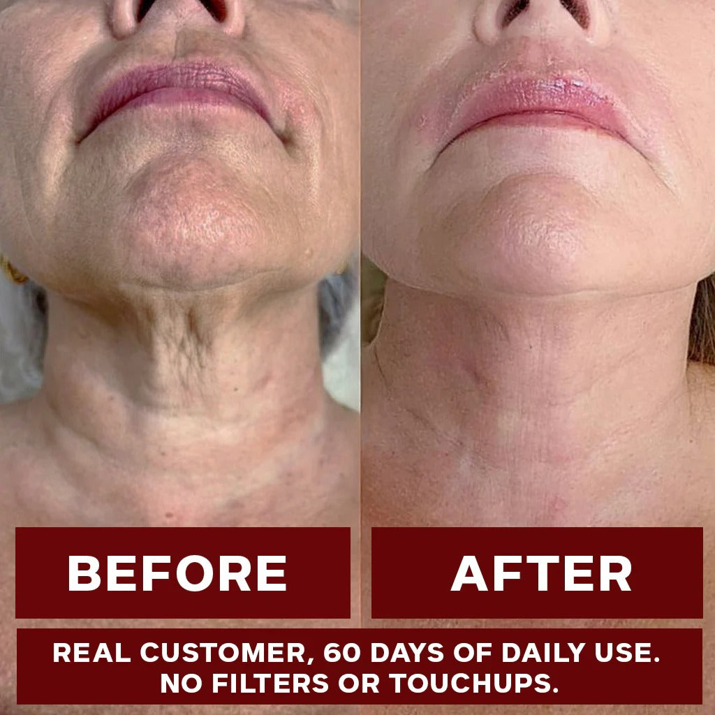 ZOOONE Liquid NAD+ 1000 mg – Berry Flavor, 30 Packets