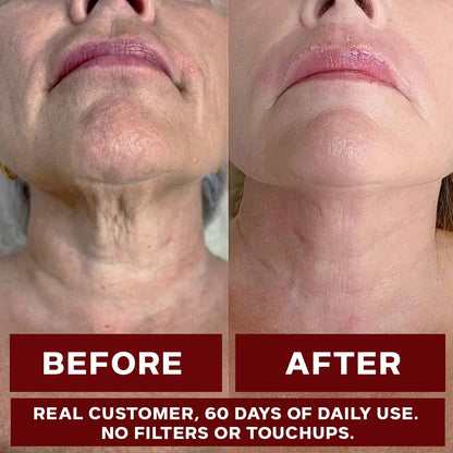 ZOOONE Liquid NAD+ 1000 mg – Berry Flavor, 30 Packets